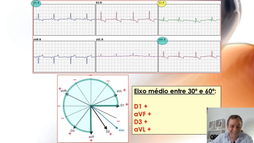 Curso online de eletrocardiografia veterinária