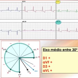 Curso online de eletrocardiografia veterinária
